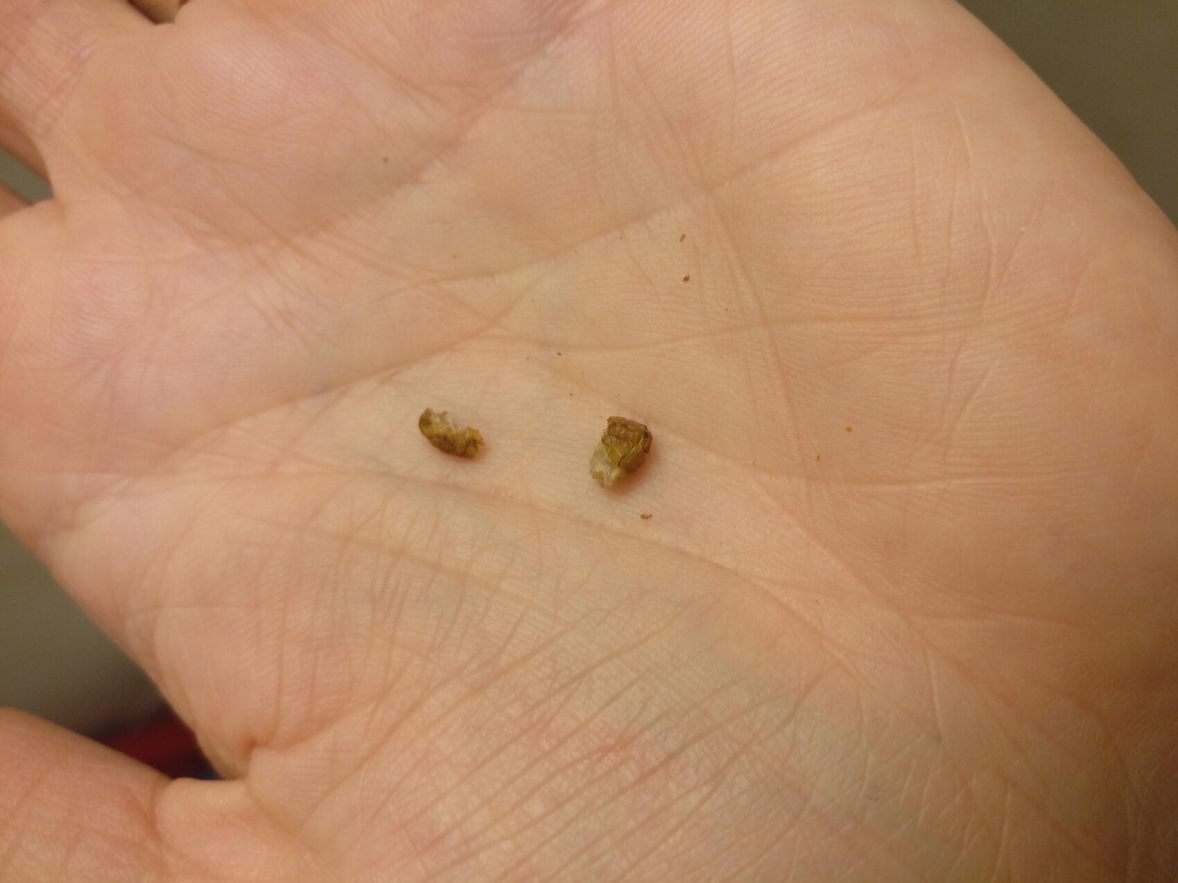 Two small brown seeds in an open palm
