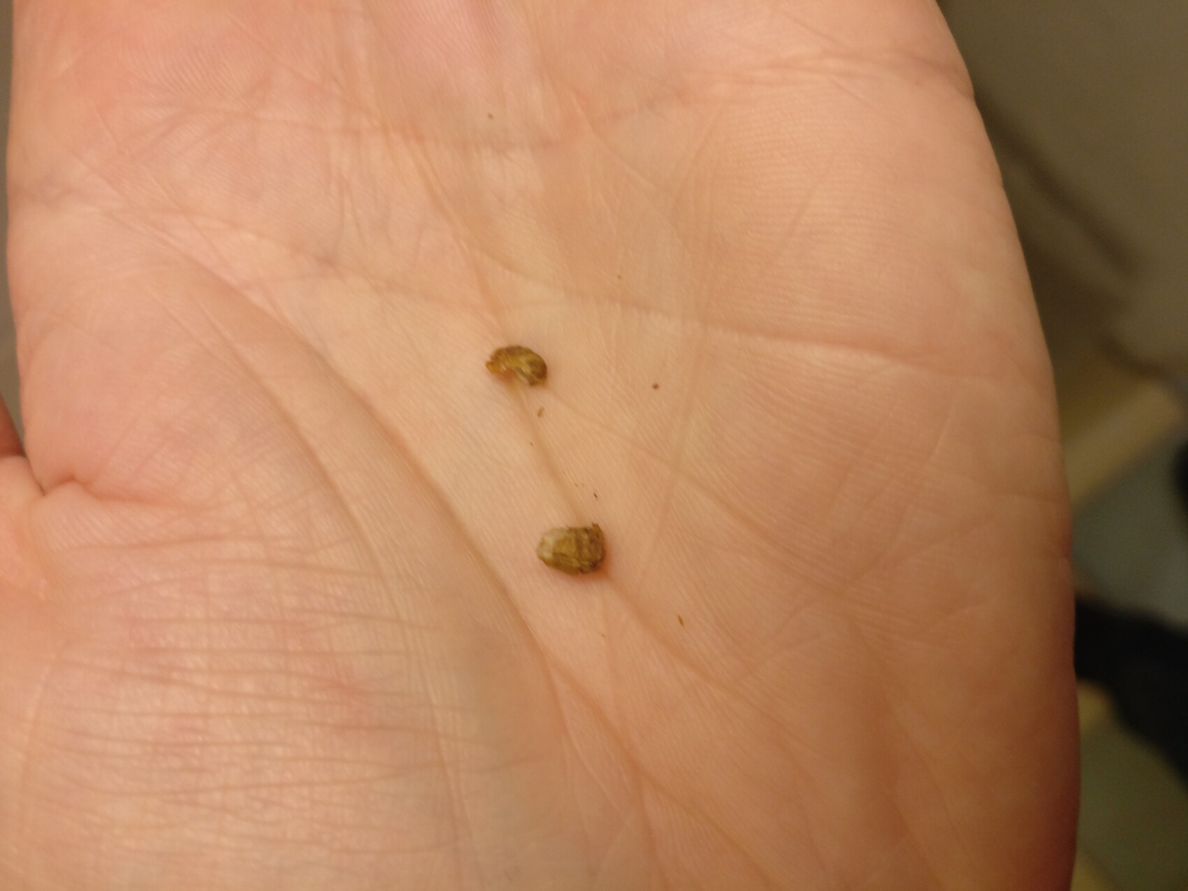 Two small brown seeds lying in the palm.